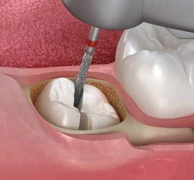 Dental Examination